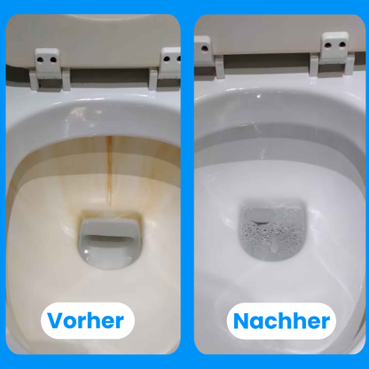 Toilet brush STEELLINE ACRYL Set